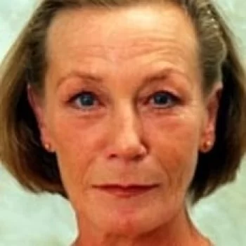 Helle Kuningas