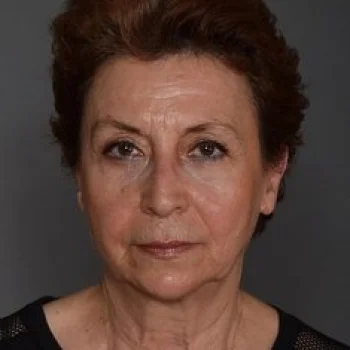 Serra Menderes